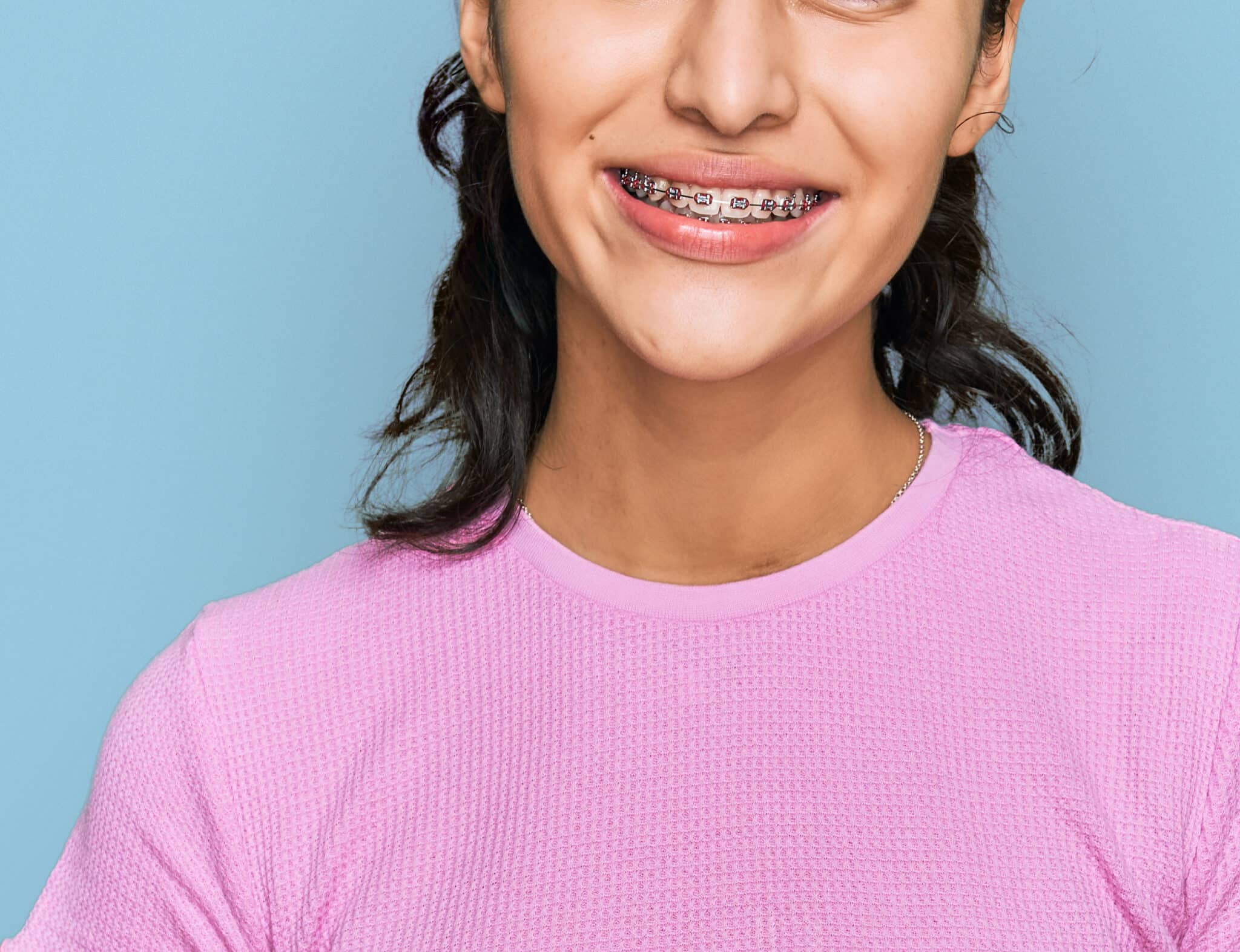 Braces 101 Everything You Need to Know to Get Started Dunegan & Cole Orthodontics