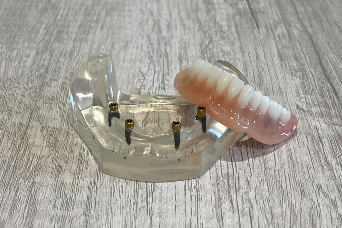 New Dental Implants Durham, NC Durham Dentures