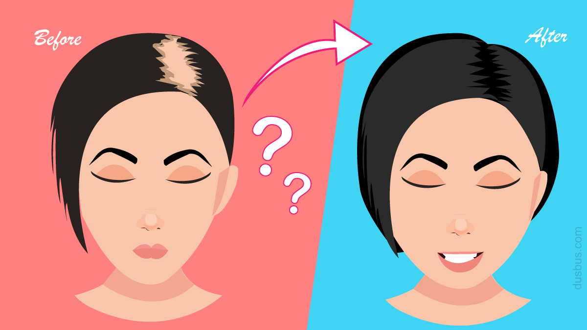 Why Do I Not Grow Hair Home Design Ideas