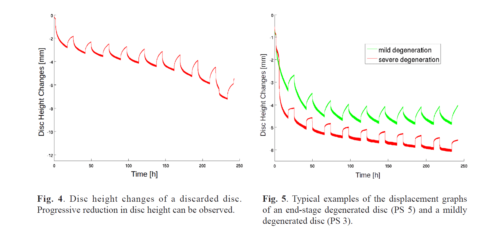 Disc Loading A Look at Degenerated vs. Normal Discs