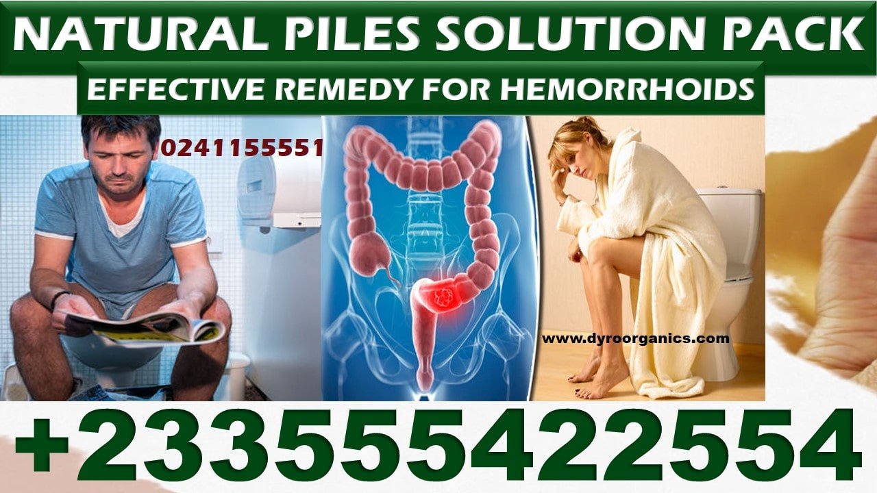 Best Herbal Medicine for Hemorrhoids in Ghana Accra Kumasi Tamale