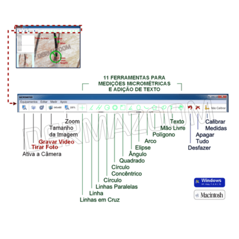 DermaZoom Micrometer