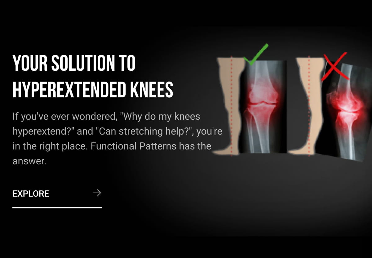 Hyperextended Knees? We have a fix! Functional Patterns