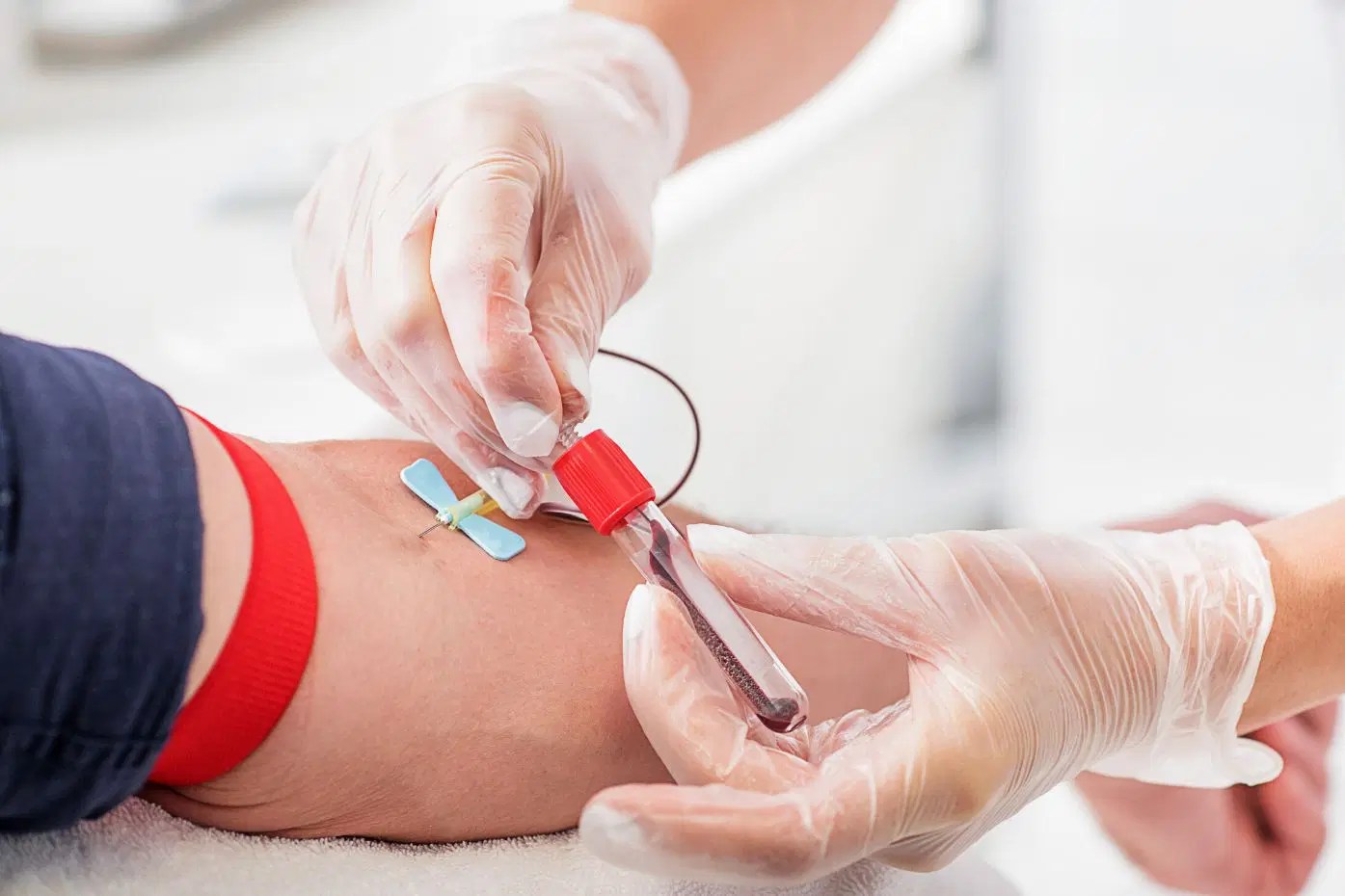 eGFR Test for Kidney Function RenalTracker Blog