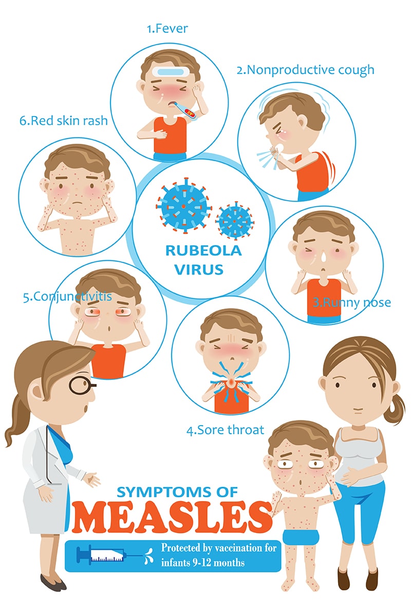 Measles, Mumps, Rubella (MMR) Titers, Antibody Immunity Test Smartly Labs