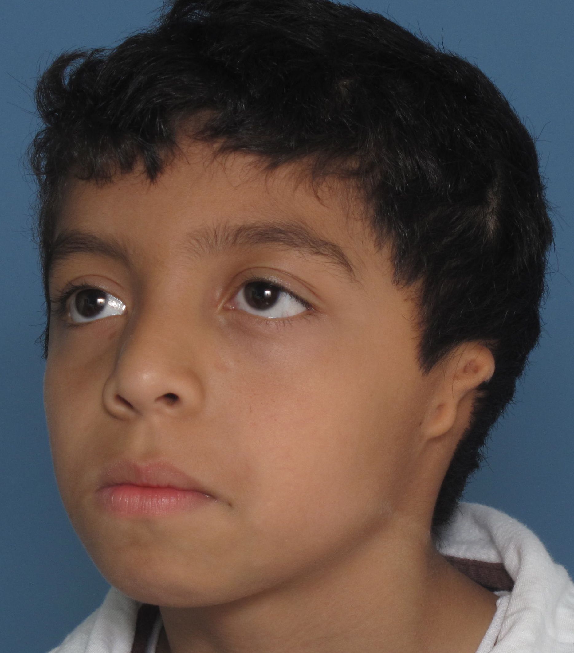 Tissue Expansion Ear Community