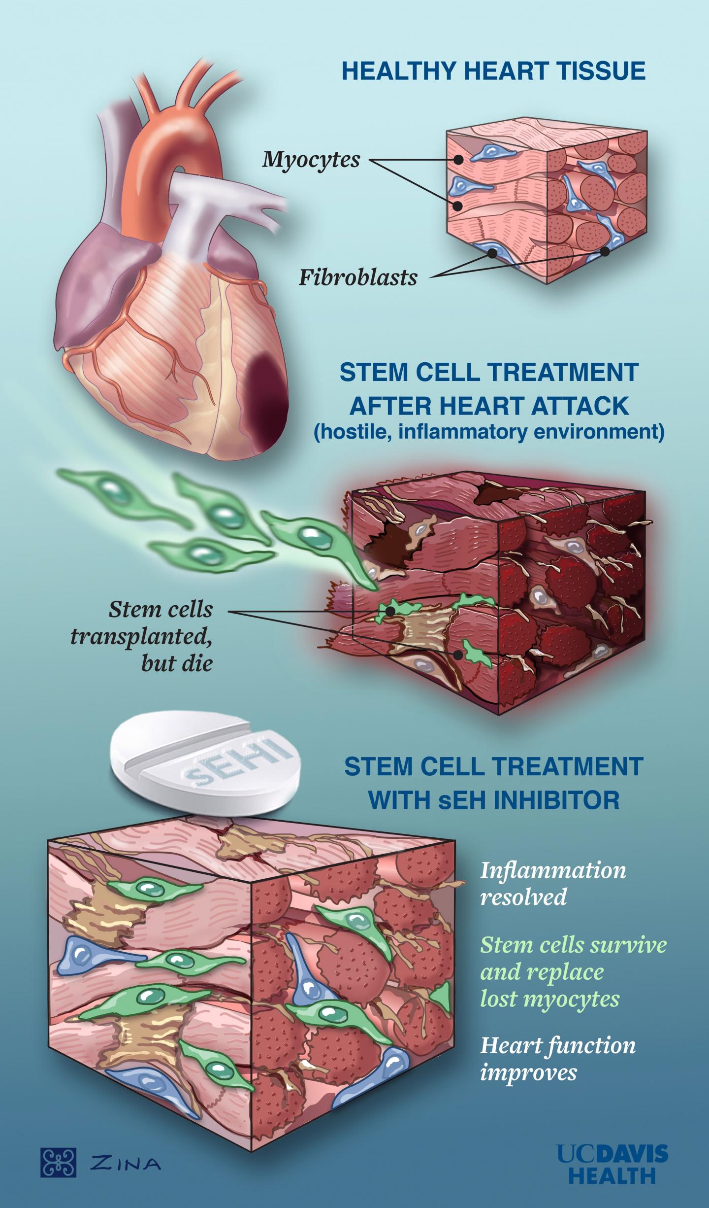 UC Davis researchers find a way to help stem cells work for the heart