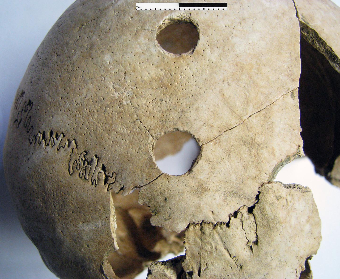 Cracked skull [IMAGE] EurekAlert! Science News Releases