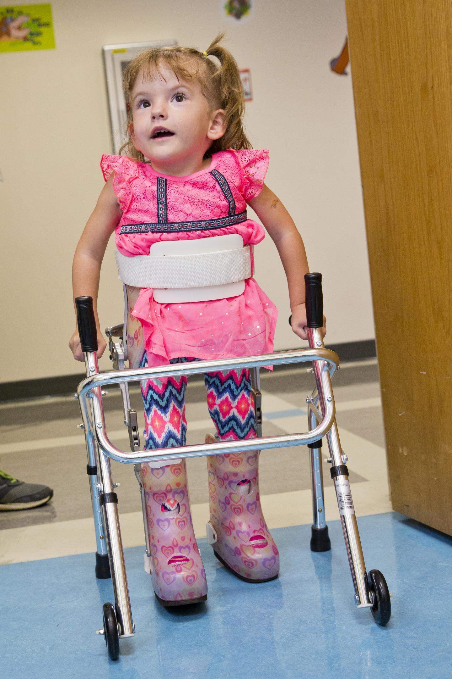 Patient with Spina Bifida [IMAGE] EurekAlert! Science News Releases