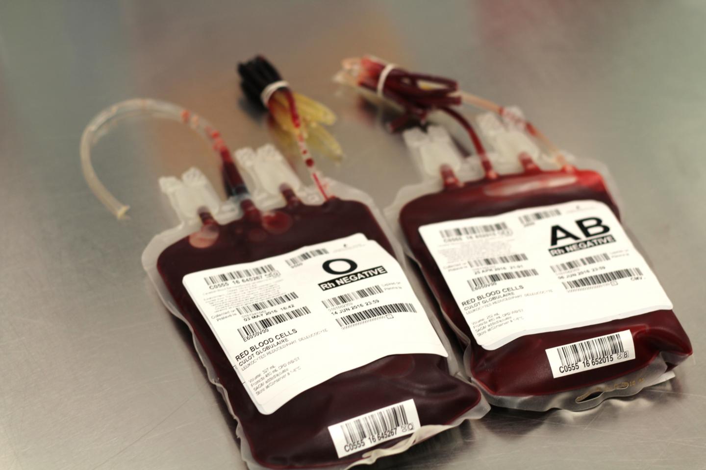 Researchers find association between donor ag EurekAlert!