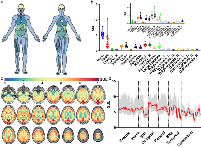 uEXPLORER PETCT generates detailed glucose u EurekAlert!