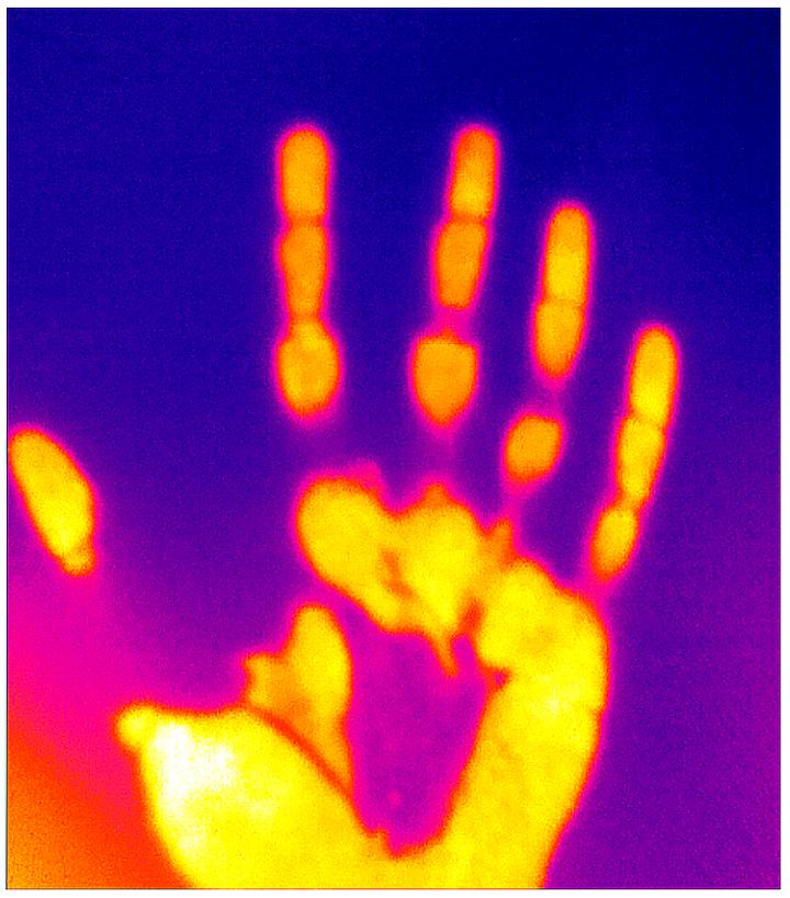 Infrared (thermal) Imaging Ha [IMAGE] EurekAlert! Science News Releases