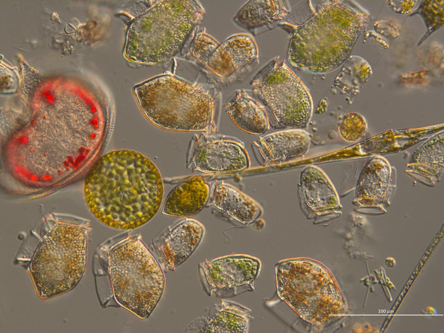 Dinoflagellates and Diatoms [IMAGE] | EurekAlert! Science News Releases