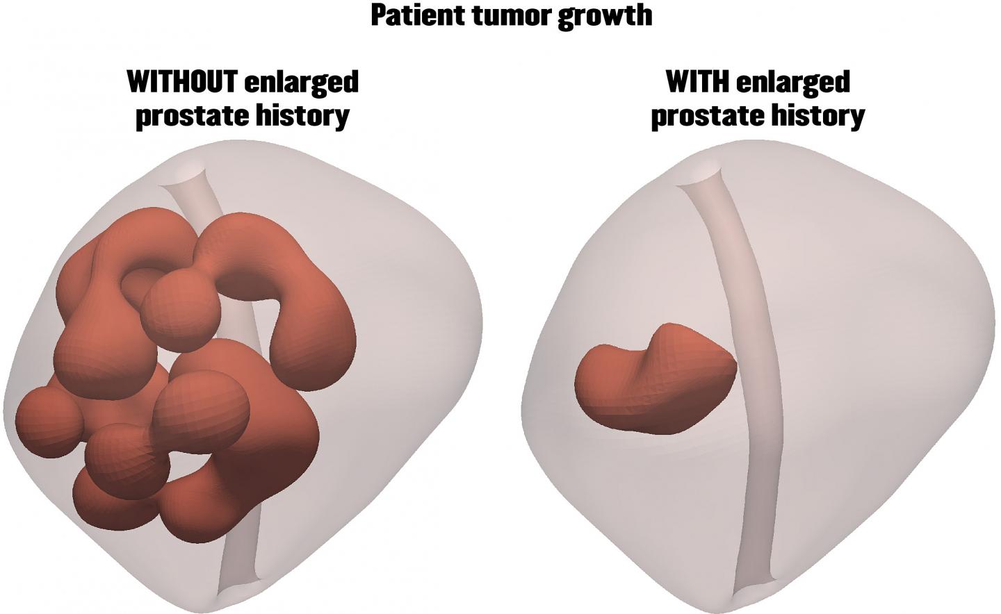Simulations of the Prostate [IMAGE] EurekAlert! Science News Releases