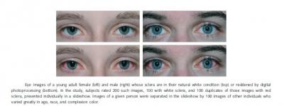 Is Beauty Found In The Whites Of The Eyes? 'R | Eurekalert!