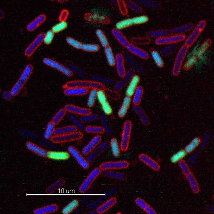 Bacterial Cell Lysis [IMAGE] EurekAlert! Science News Releases