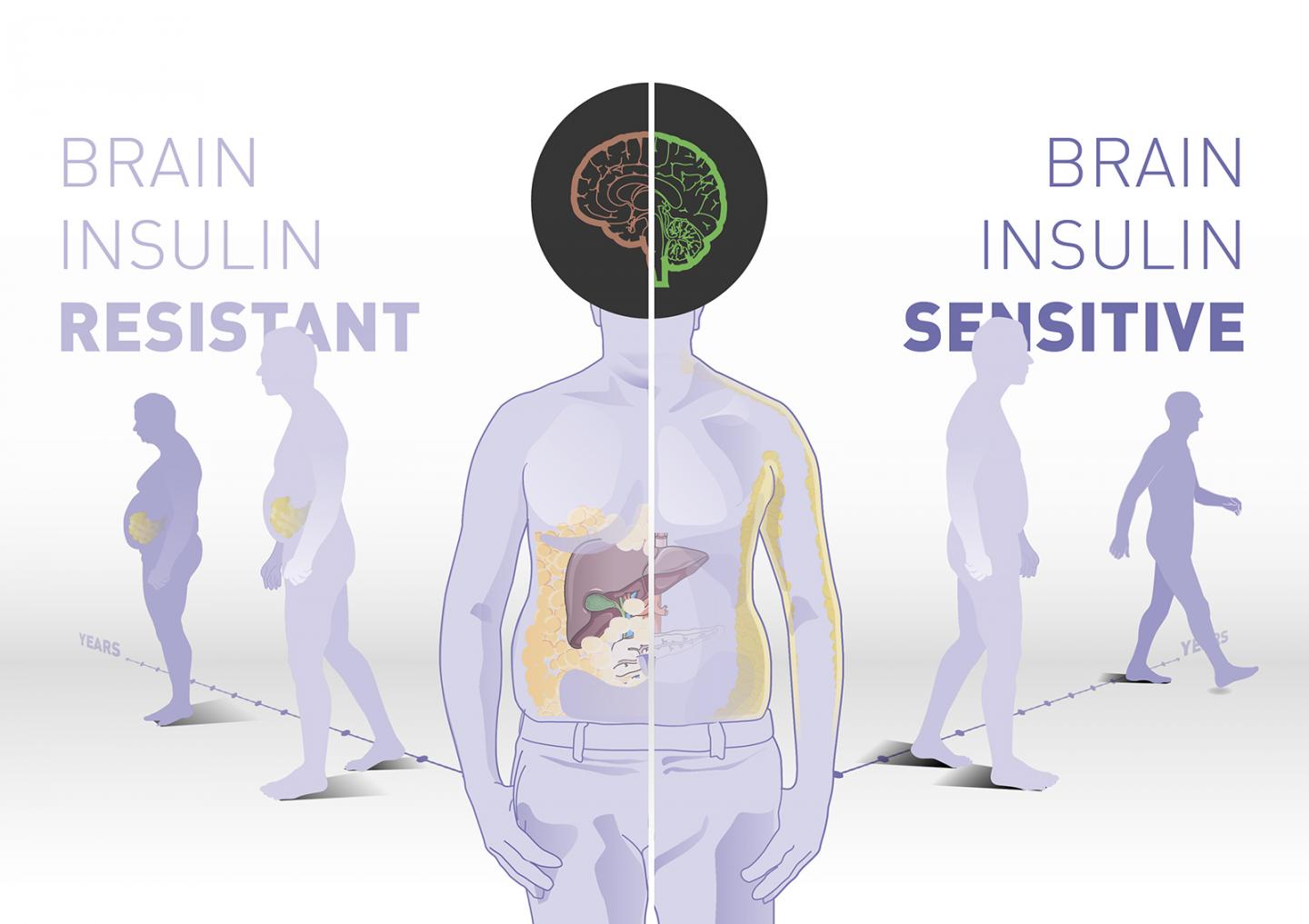 Brain insulin sensitivity determines body weight and fat distribution