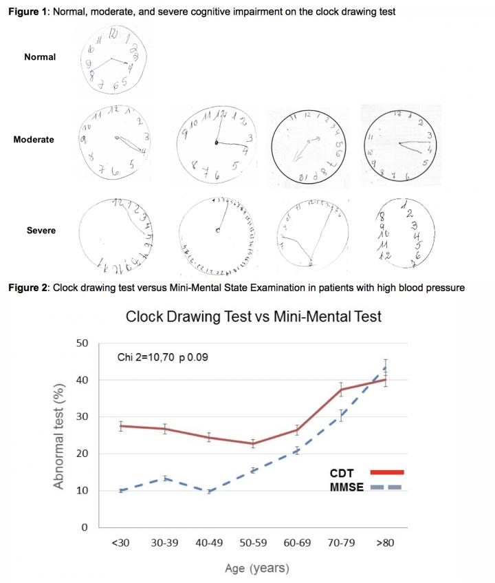 Clock drawing cognitive test should be done r EurekAlert!