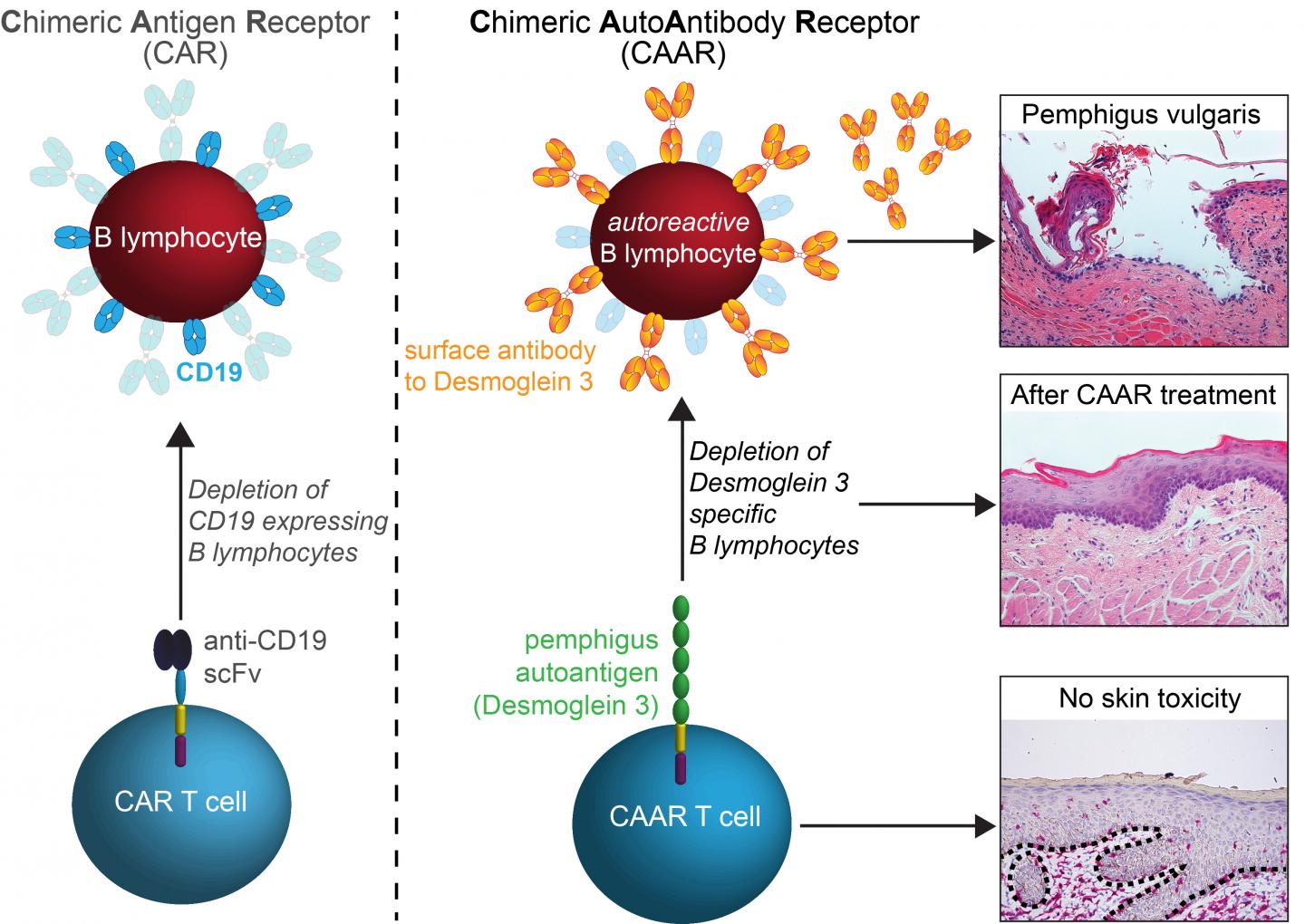 CAAR Treating Autoimmune Dise [IMAGE] EurekAlert! Science News Releases