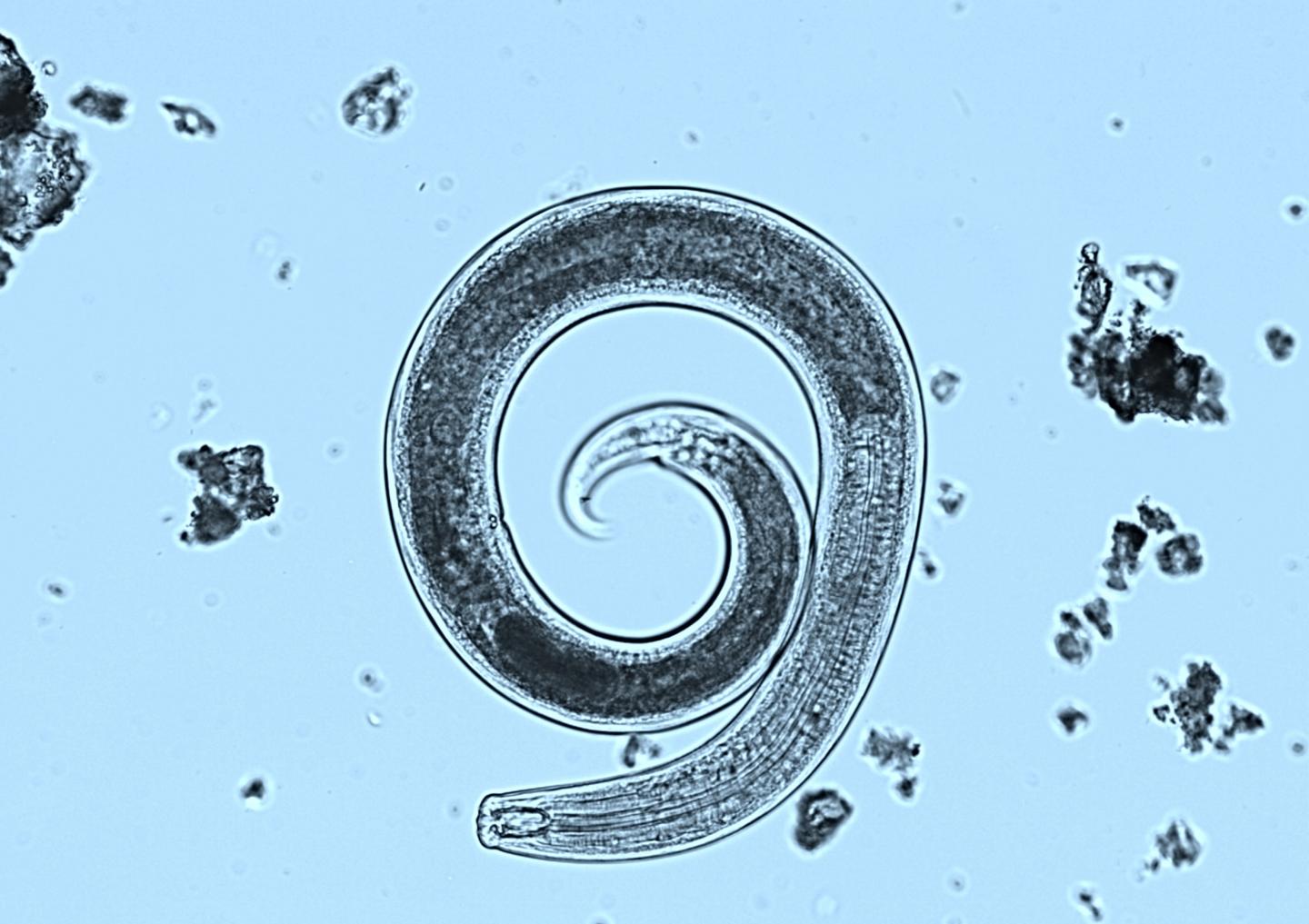 Nematode under Microscope [IMAGE] EurekAlert! Science News Releases