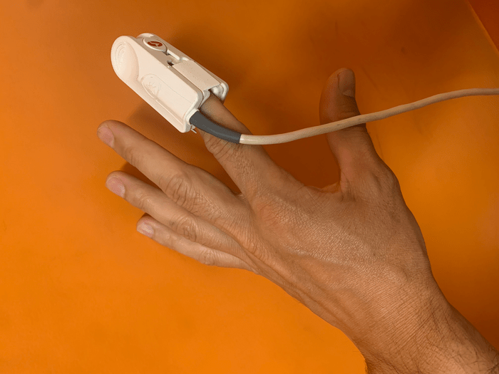 Test for carbon monoxide poisoning is unrelia EurekAlert!