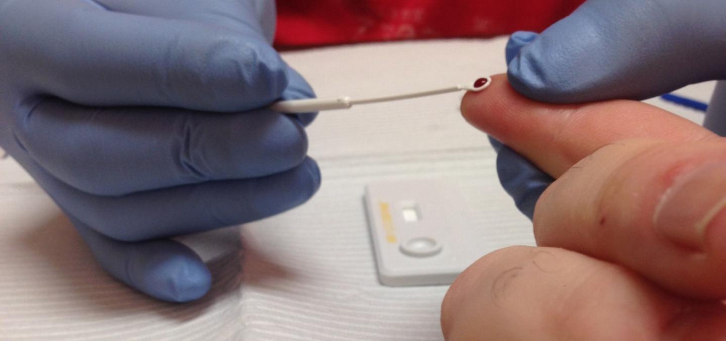 Rapid HIV Test [IMAGE] EurekAlert! Science News Releases