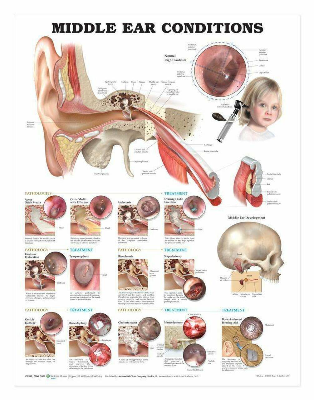 Middle Ear Conditions Chart - EAR Customized Hearing Protection