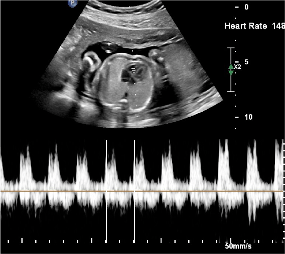 3D/4D Ultrasound Earlyview