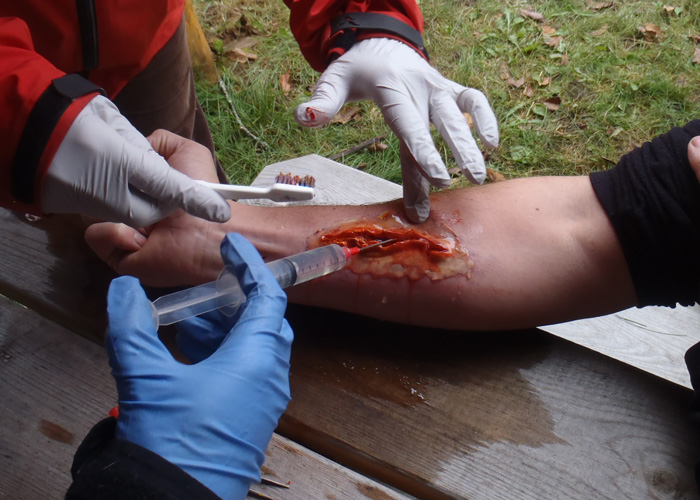 Wilderness First Aid Are You Prepared For Trouble?