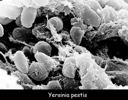 Facts for Kids about What is the Black Death?