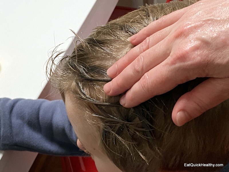Using Coconut Oil For Lice Results And How To Use It.