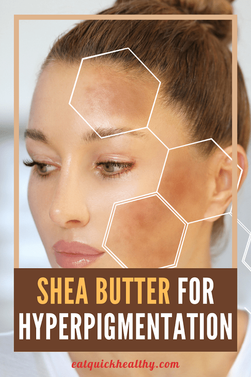 How To Use Shea Butter For Hyperpigmentation For Best Results Eat