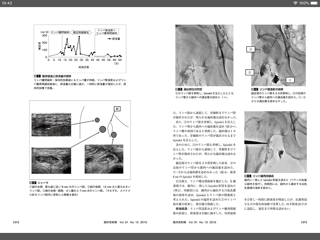 電子書籍版｜臨床放射線 2016年10月号 61巻10号 特集 粒子線治療の現状─保険適用を経ての実施体制─【電子版】 M2PLUS