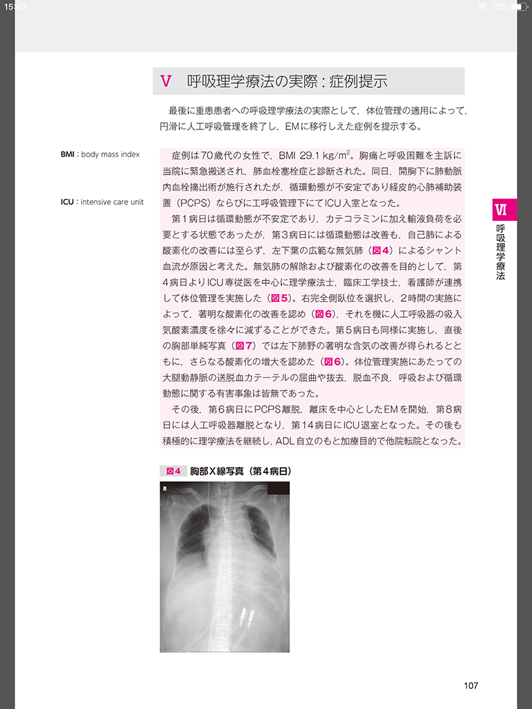 電子書籍版｜早期リハビリテーションの実践 予後改善のためのアプローチ M2PLUS