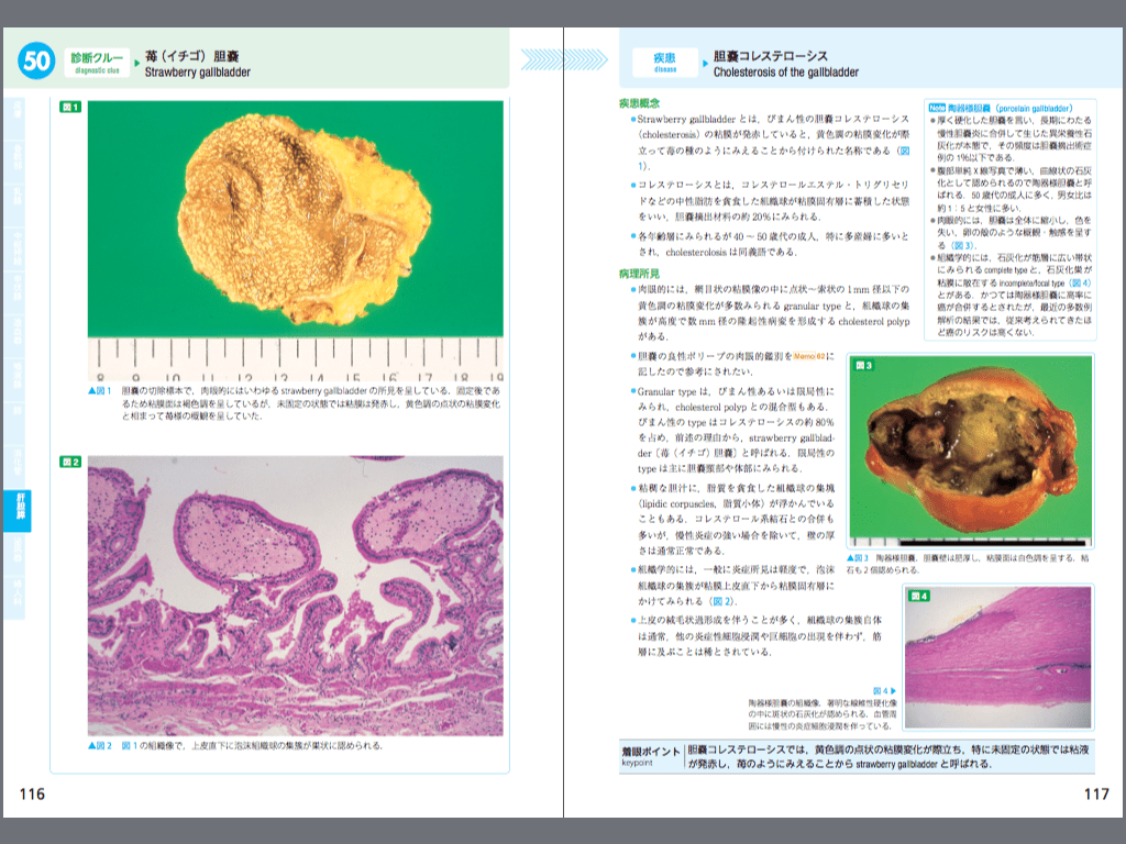 電子書籍版｜病理診断を極める60のクルー M2PLUS
