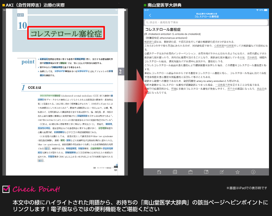 電子書籍版｜AKI（急性腎障害）治療の実際 M2PLUS