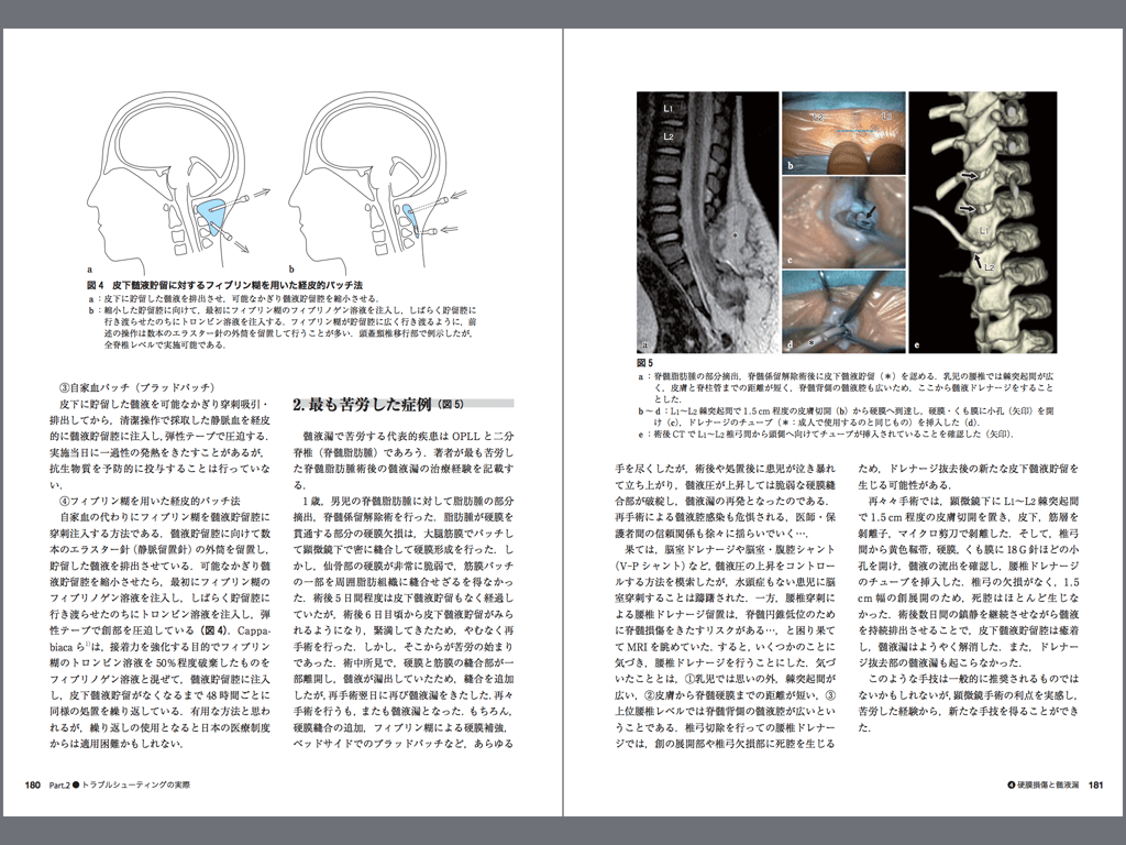電子書籍版｜脊椎脊髄術中・術後のトラブルシューティング 第2版 M2PLUS