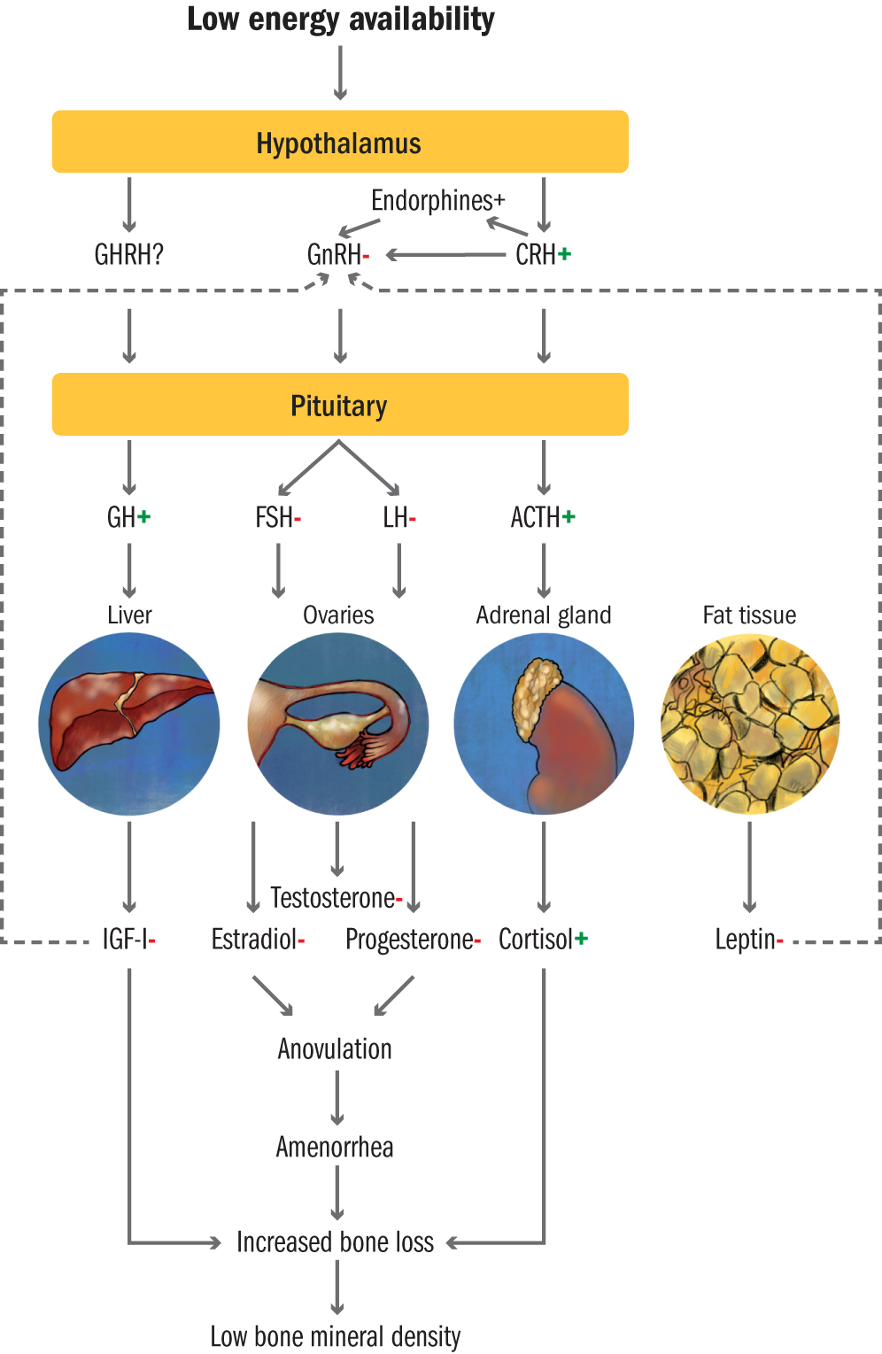 Amenorrhea In Athletes