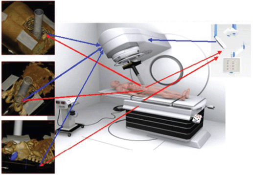 Intraoperative radiotherapy with electrons fundamentals, results, and