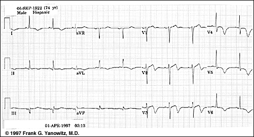 ECG Learning Center An introduction to clinical electrocardiography