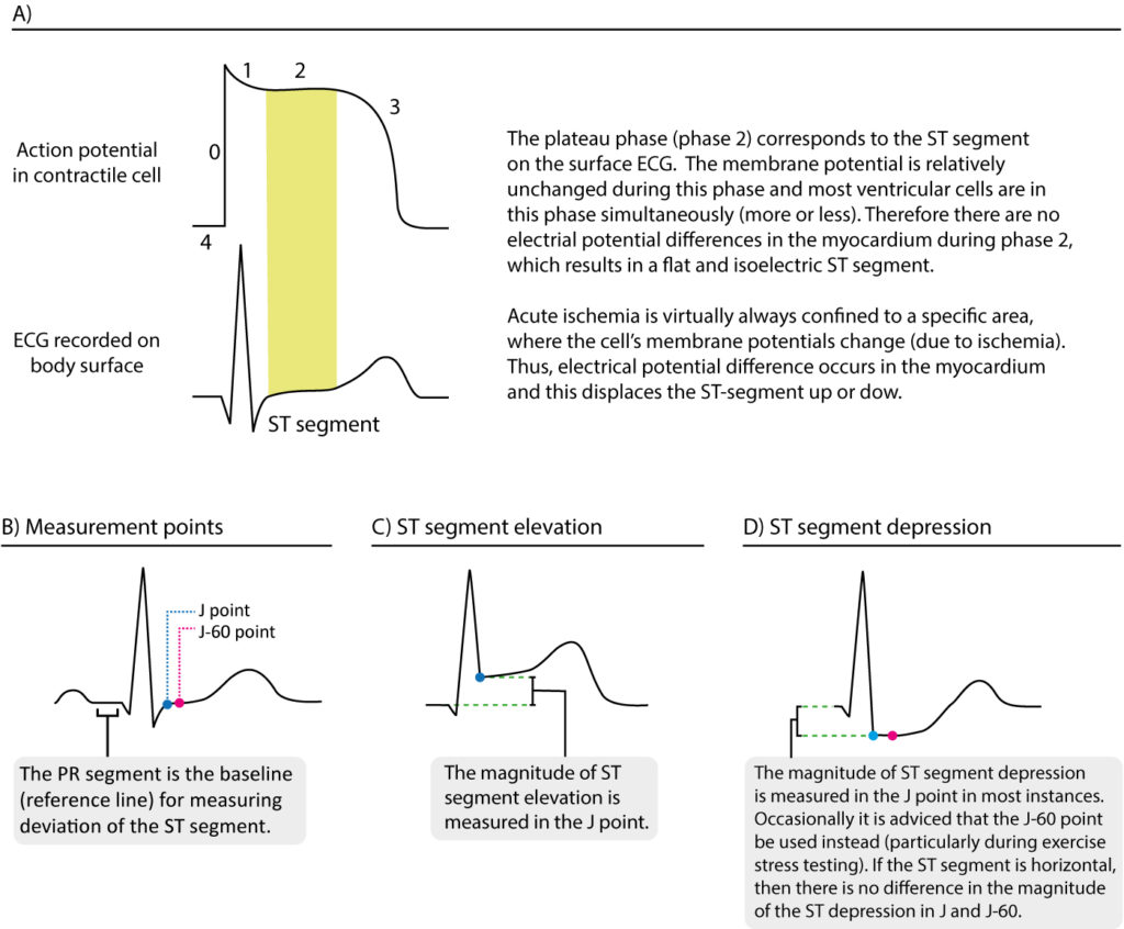 ECG interpretation Characteristics of the normal ECG (Pwave, QRS