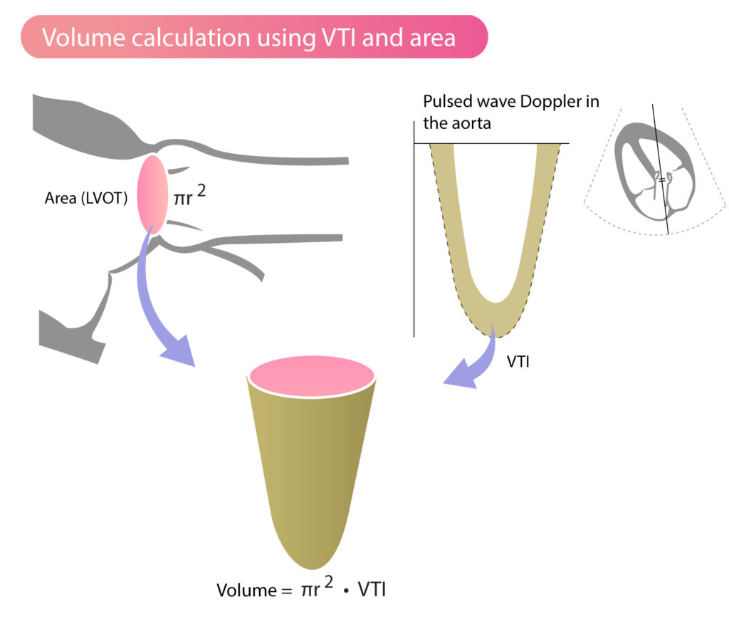 Stroke Volume, VTI (Velocity Time Integral) & Cardiac Output ECG & ECHO