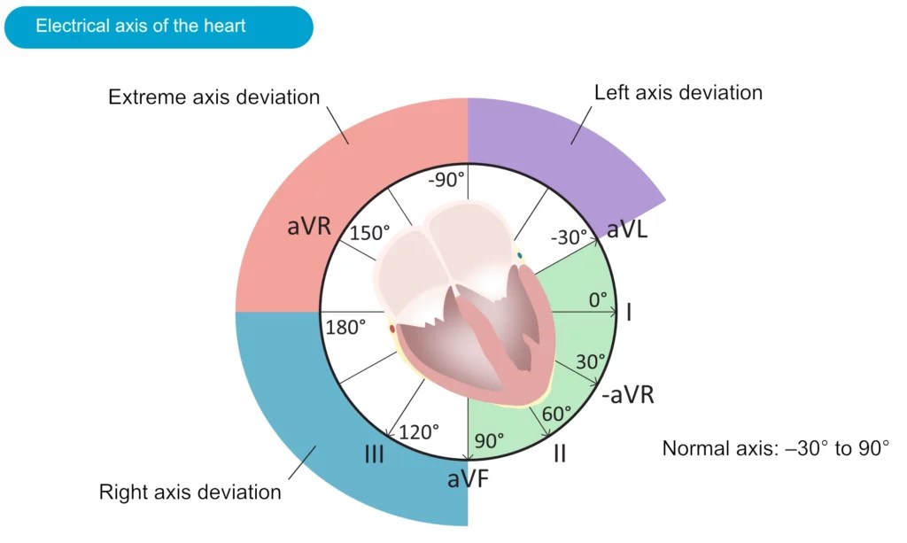 The electrical axis of the heart (ECG axis)