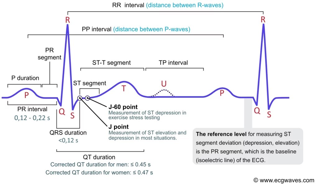 ECG interpretation Characteristics of the normal ECG (Pwave, QRS