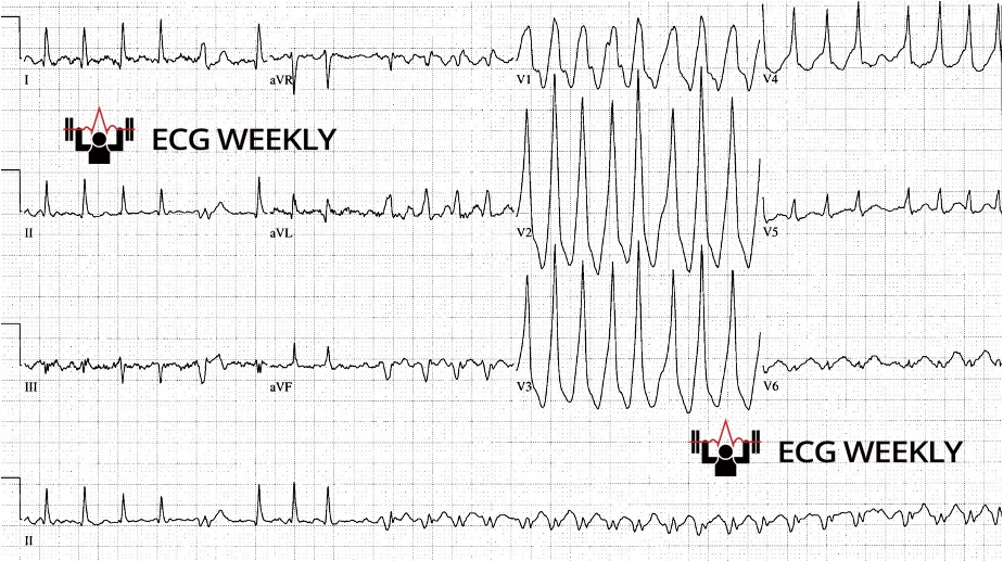 2024 EM Boards ECG Review Part I ECG Weekly