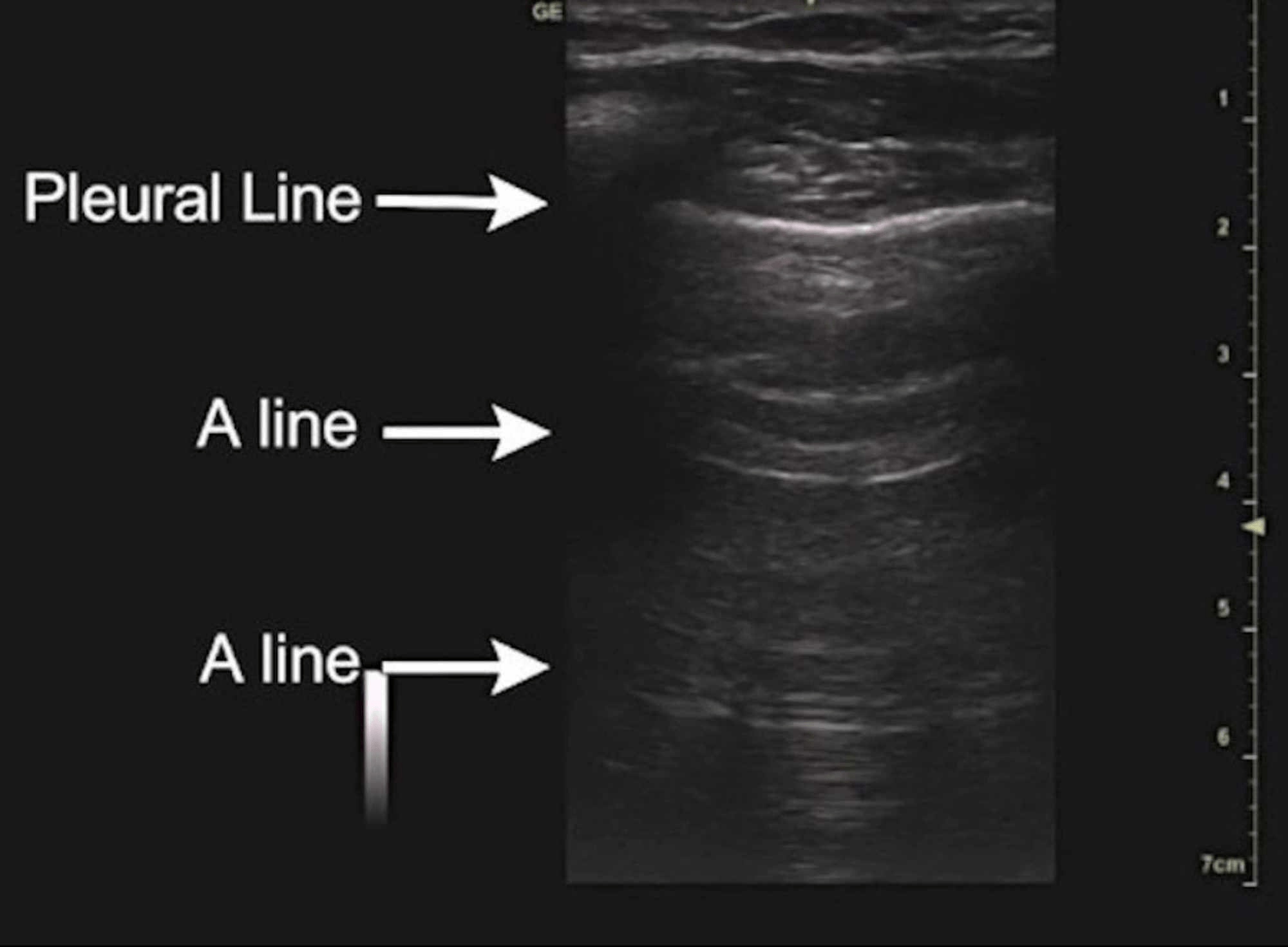 Radiographie D Une Secte Au Dessus De Tout Soupã â On.