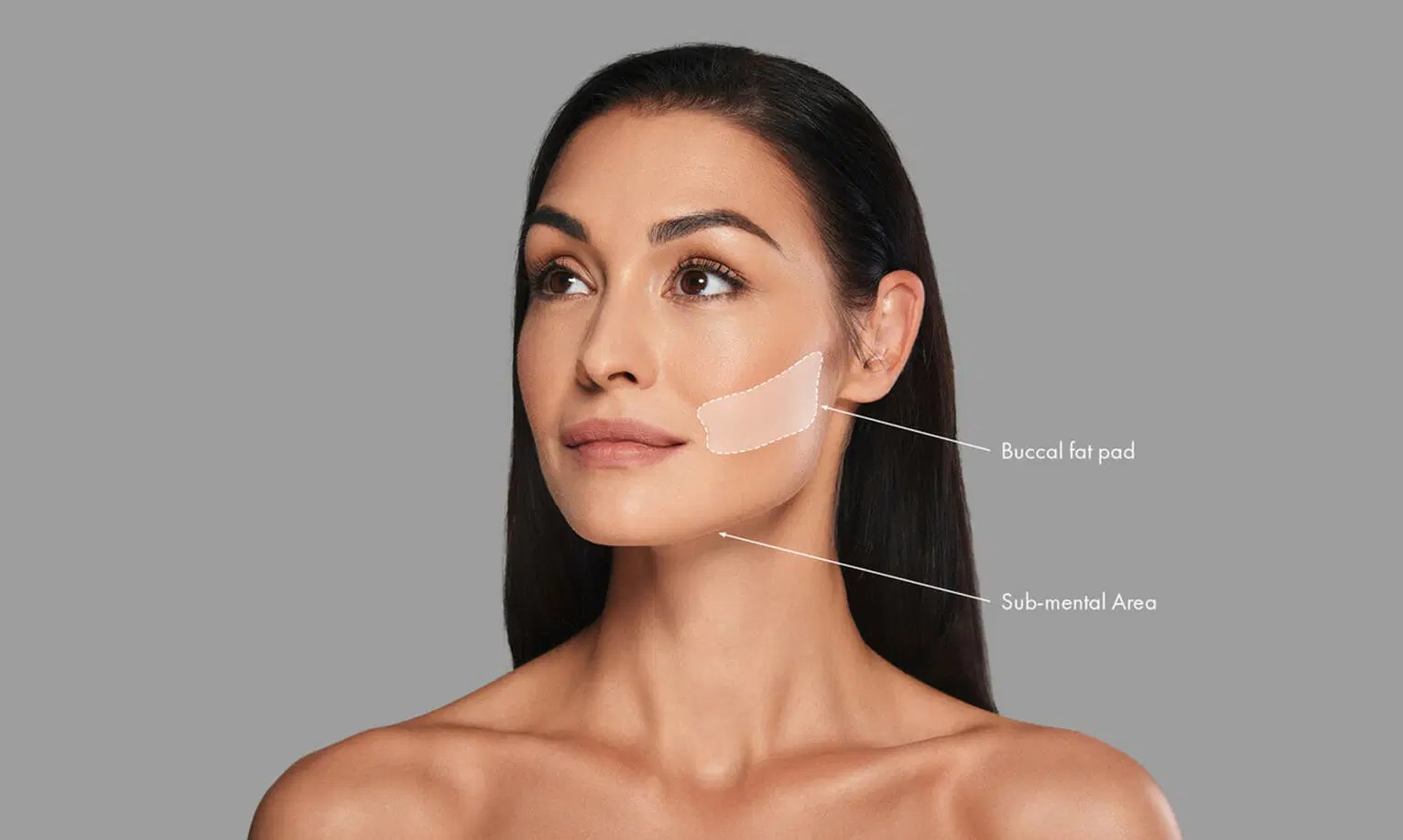 Buccal Fat Removal Cheek Contouring Surgery UK Bella Vou