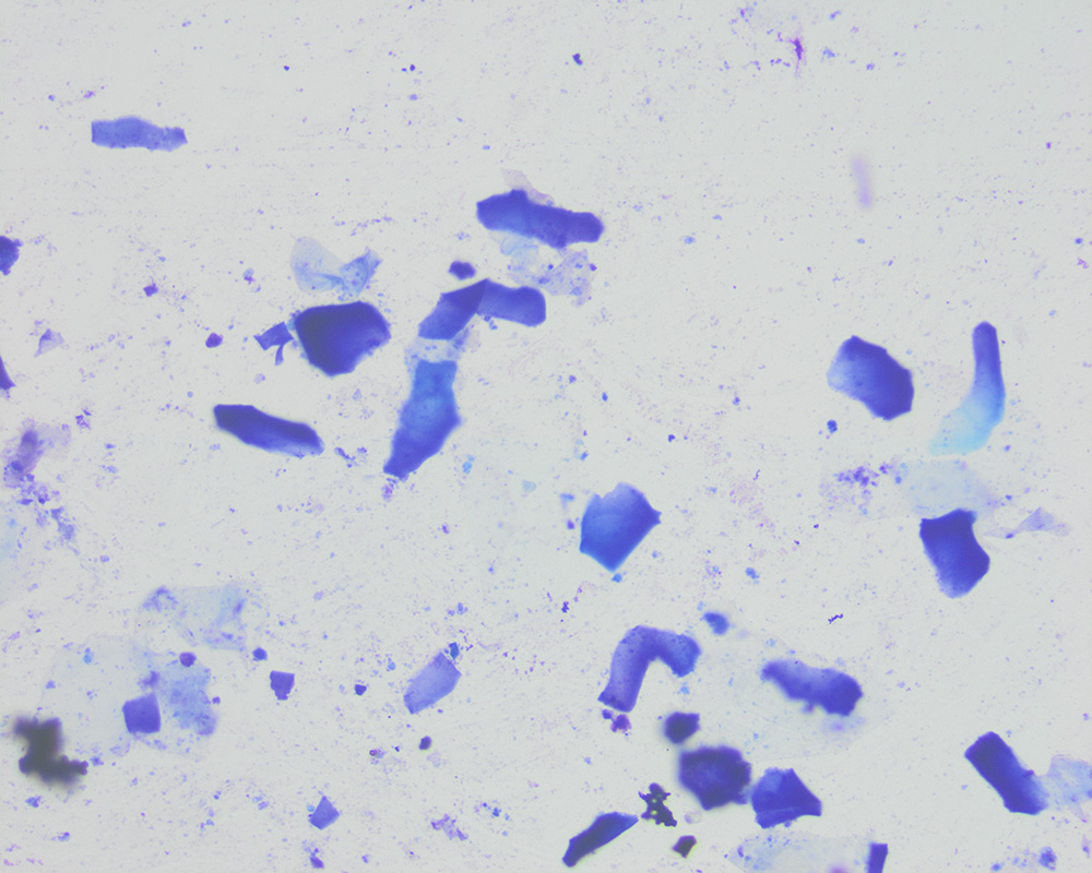 keratin Archives eClinpath