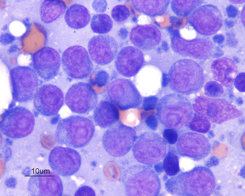 Images tagged "lymphoma" eClinpath