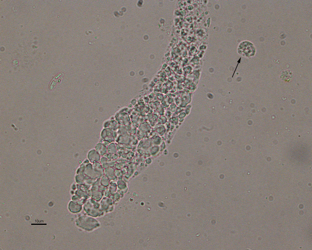 Urine casts eClinpath